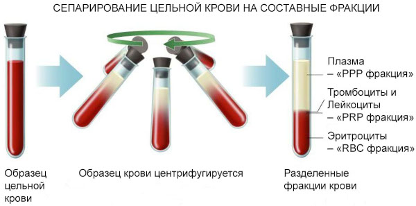 Биохимический анализ крови. Сколько делается, натощак или нет
