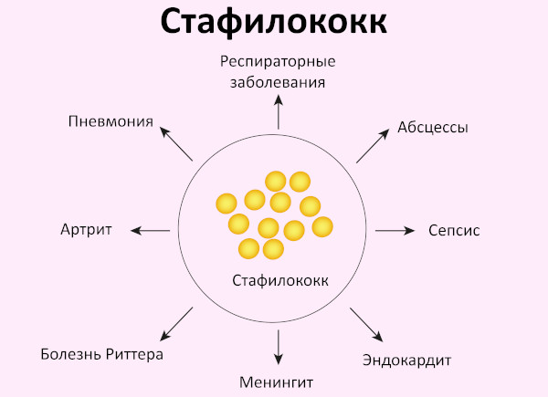 Боль в сосках у женщин. От чего болят соски, в области соска