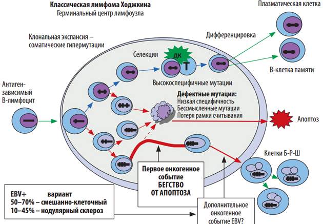 Болезнь Ходжкина (нодулярный склероз). Что это, анализ, патогенез, клинические рекомендации