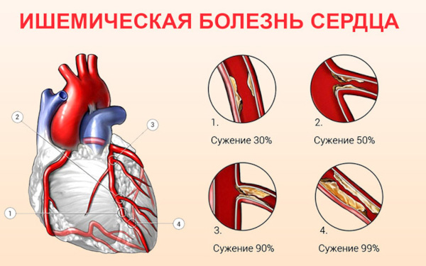 Болезненность молочных желез: жжение, покалывание, набухание. Причины