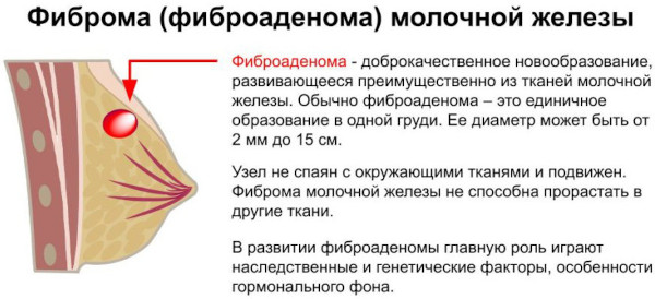 Болезненность молочных желез: жжение, покалывание, набухание. Причины