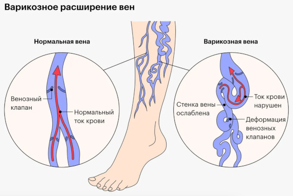 Биофлавоноиды препараты. Что это такое простыми словами