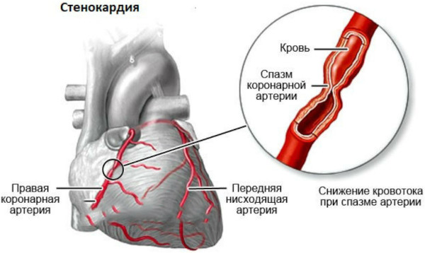 Болит молочная железа при надавливании сбоку. Причины у женщин
