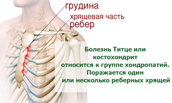 Болит молочная железа при надавливании сбоку. Причины у женщин