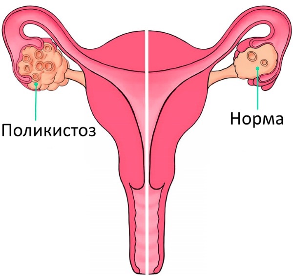 Гинекологическое УЗИ: виды, как называется ультразвуковое исследование внутренних органов