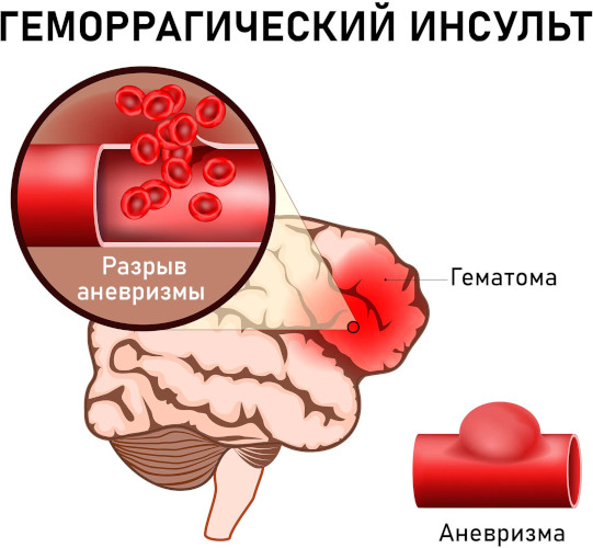 Целебрекс (Celebrex). Инструкция по применению, цена, отзывы