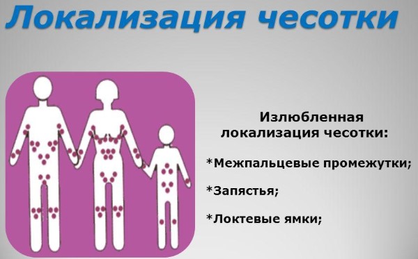 Чешется в паху у мужчин. Причины зуда по ночам, аллергический, раздражение, опрелость. Лечение