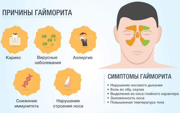 Экссудативный гайморит. Что это, лечение у взрослых без прокола