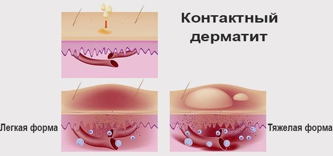 Рекицен-РД. Инструкция по применению, цена, отзывы