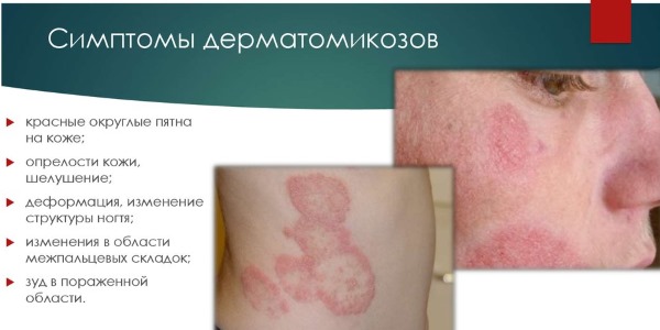 Почему чешутся соски у женщины. Причины зуда
