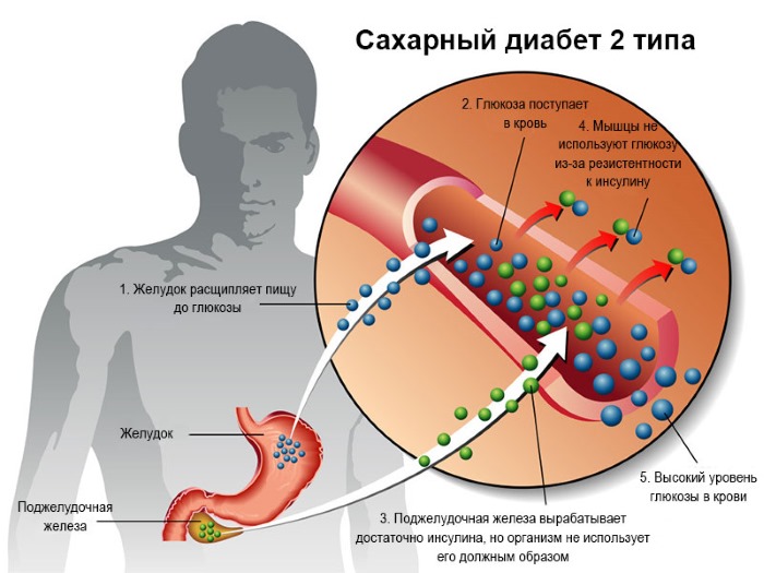 Препараты для снижения сахара в крови. Таблетки, список