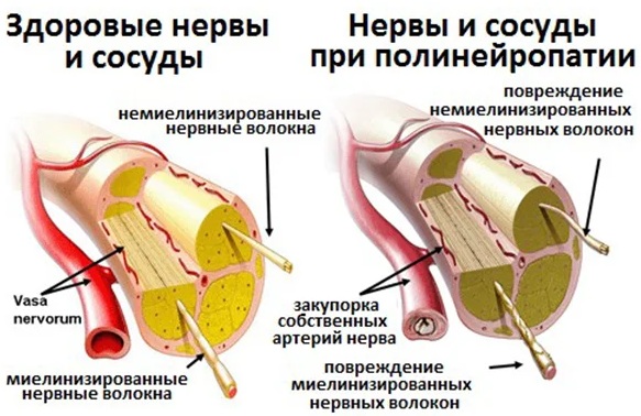 Манинил (Maninil) таблетки. Инструкция по применению