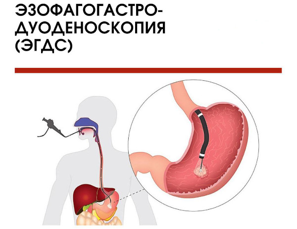 Диагностика поджелудочной железы. Анализы, как проверить