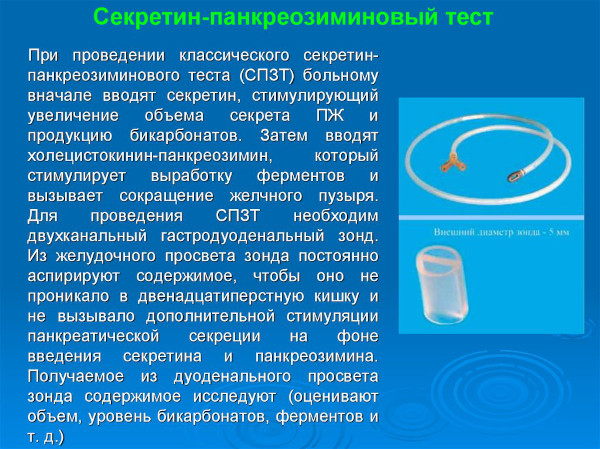 Диагностика поджелудочной железы. Анализы, как проверить