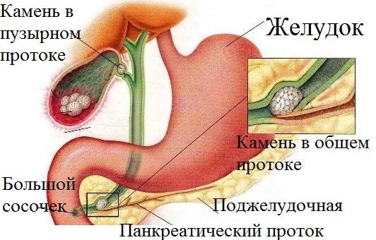 Стол №8. Диета при ожирении, меню на неделю, рецепты блюд для похудения. Таблица продуктов для детей и взрослых