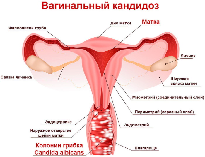 Заболевания мочевыделительной системы у женщин. Симптомы и лечение