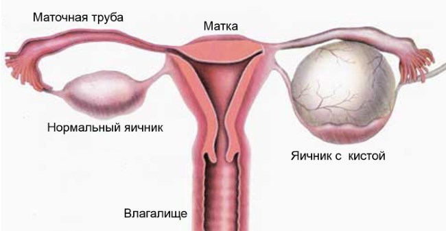 Гинекологическое УЗИ: виды, как называется ультразвуковое исследование внутренних органов