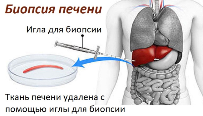 Как проверить печень на заболевания, анализы, анализы, врачи