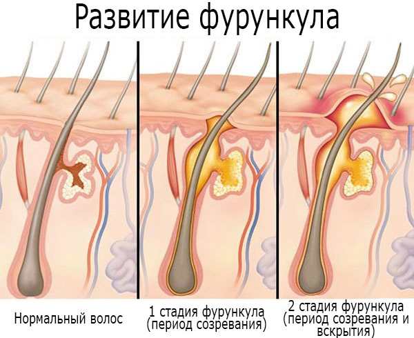 Глево (Glevo) таблетки. Инструкция по применению, цена, отзывы