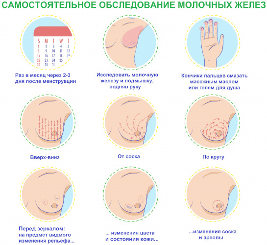 Галактоцеле молочной железы. Что это такое, лечение