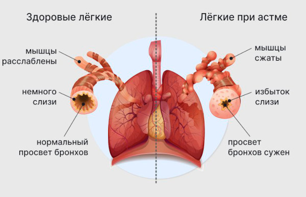 Генитрон (Genitron) уколы. Инструкция по применению, цена