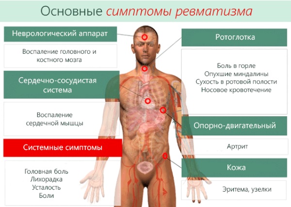 Анализ на ревмопробы. Цена, что показывает, расшифровка, как сдавать, подготовка