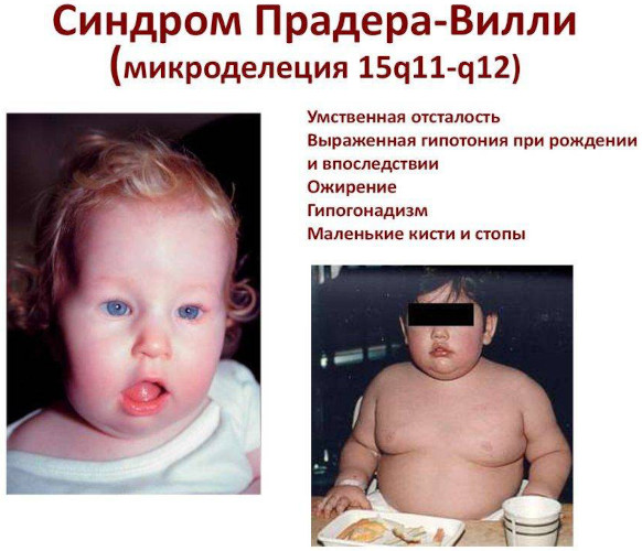 Гипогонадотропный гипогонадизм у мужчин. Клинические рекомендации