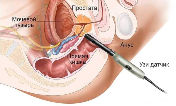 Гипогонадотропный гипогонадизм у мужчин. Клинические рекомендации