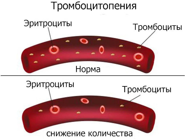 Глибомет (Glibomet) таблетки. Инструкция по применению, отзывы