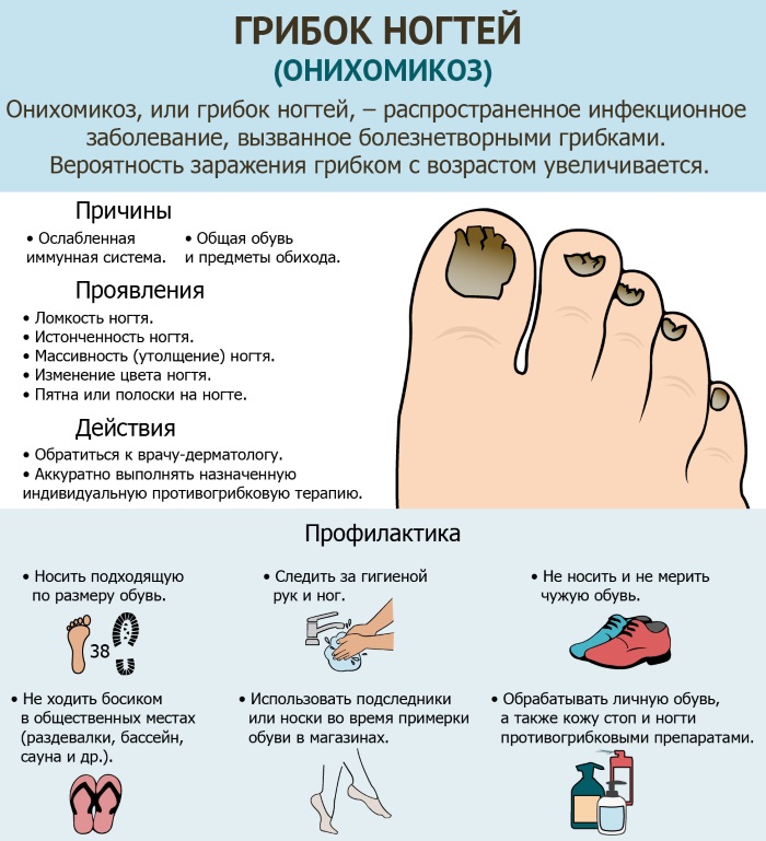 Лоцерил (Loceryl). Инструкция по применению, цена, отзывы