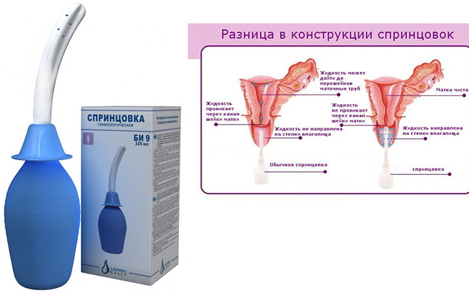 Груша для спринцевания гинекологические. Виды, какая лучше