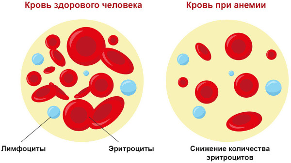 Химиотерапия при онкологии. Последствия для организма