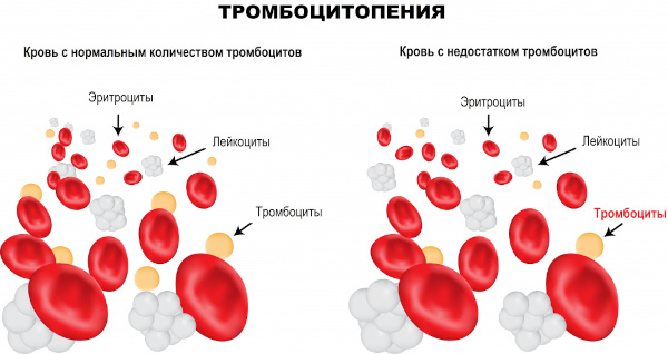 Химиотерапия при онкологии. Последствия для организма