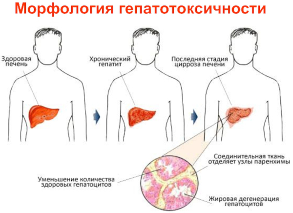 Химиотерапия при онкологии. Последствия для организма