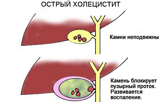 Как проверить печень на заболевания, анализы, анализы, врачи