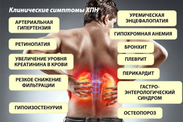 Предуктал или Триметазидин. Что лучше, отзывы