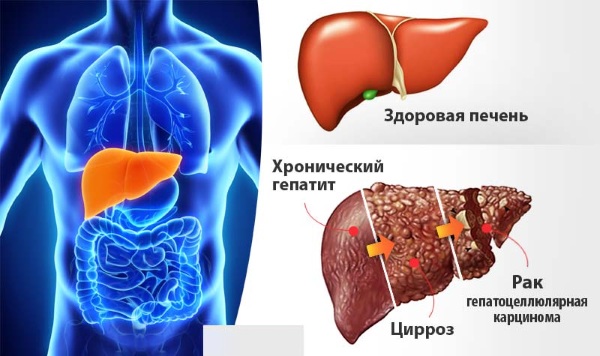 Как проверить печень на заболевания, анализы, анализы, врачи