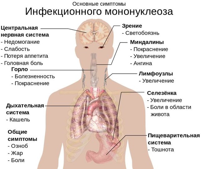 Мононуклеоз анализ крови: показатели, расшифровка, лечение
