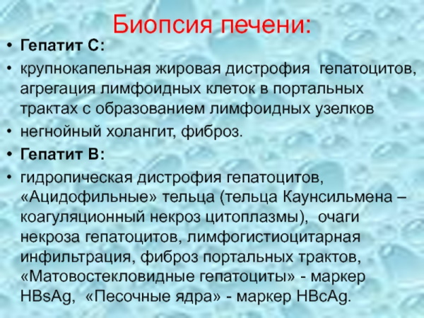 Как проверить печень на заболевания, анализы, анализы, врачи
