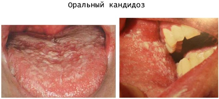 Болезни полости рта и зубов. Фото, причины и лечение