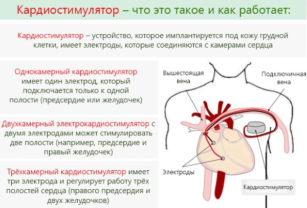 МРТ малого таза. Подготовка у женщин к исследованию, что показывает с контрастированием