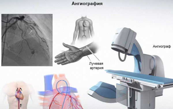 Дрожание (тремор) ног и слабость. Причины, лечение