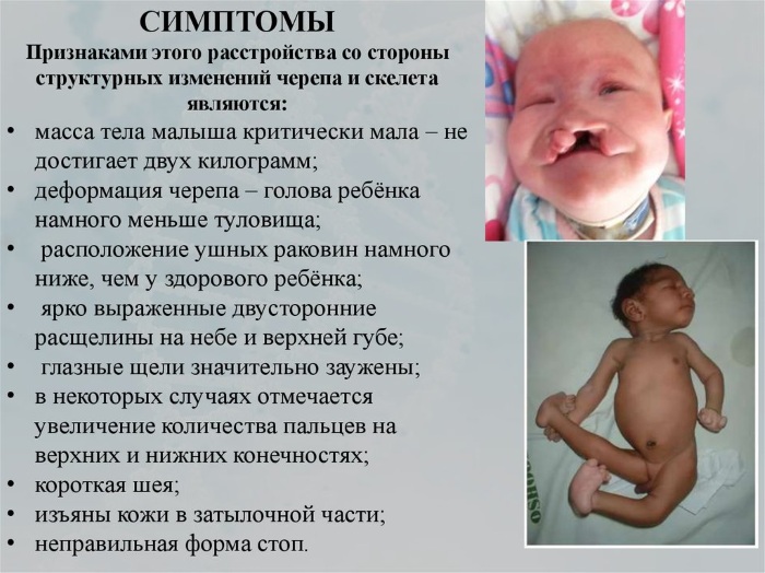 Сколько хромосом у человека в норме. Количество, классификация, патологии