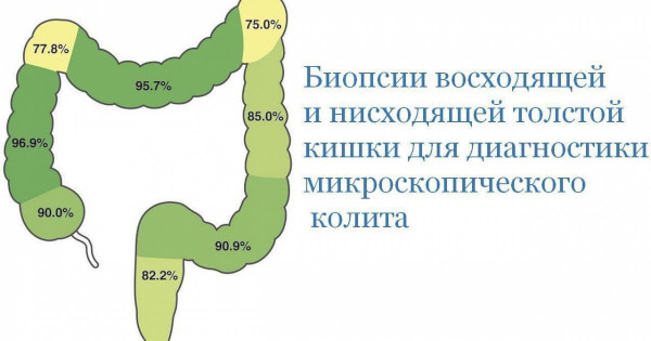 Колит кишечника у ребенка. Симптомы и лечение