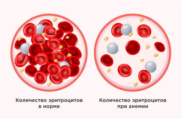 Колит кишечника у ребенка. Симптомы и лечение