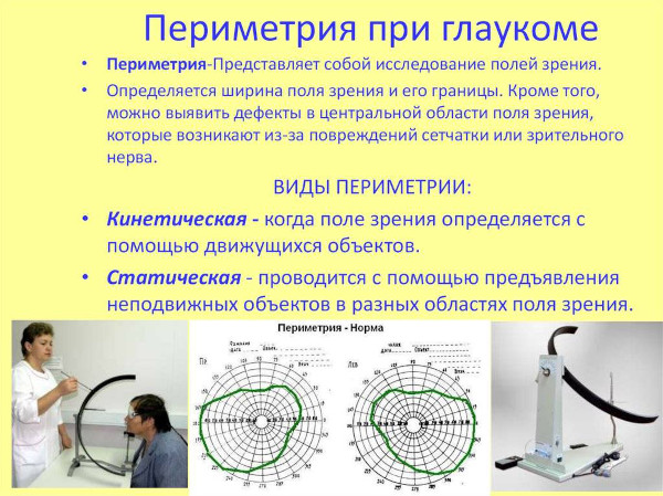 Компьютерная периметрия глаза. Что это такое в офтальмологии