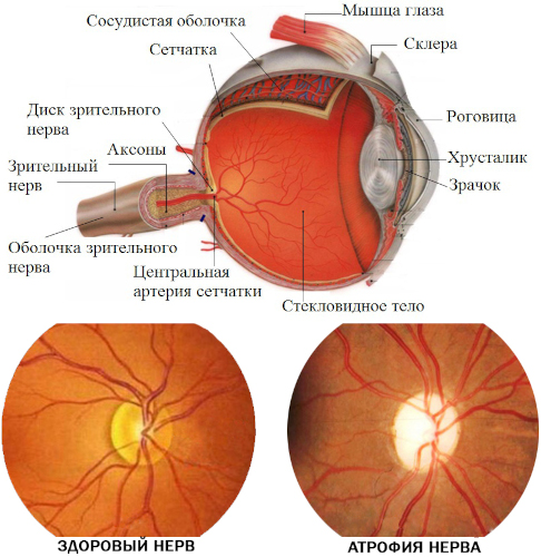 Компьютерная периметрия глаза. Что это такое в офтальмологии