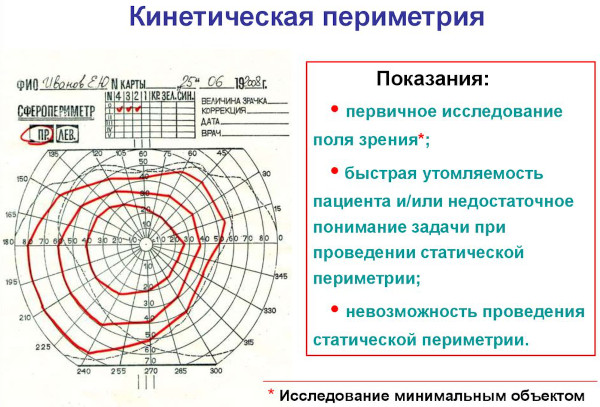 Компьютерная периметрия глаза. Что это такое в офтальмологии