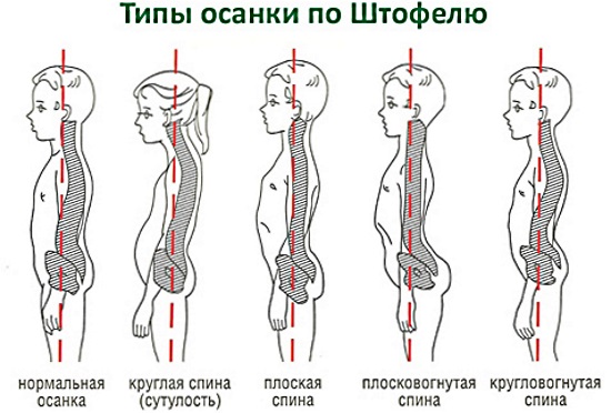 Массаж шеи и плеч. Как правильно делать в домашних условиях
