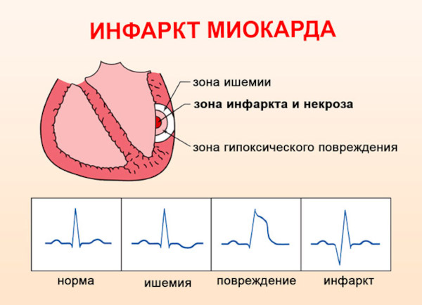 Кортексин таблетки. Инструкция по применению, цена, отзывы